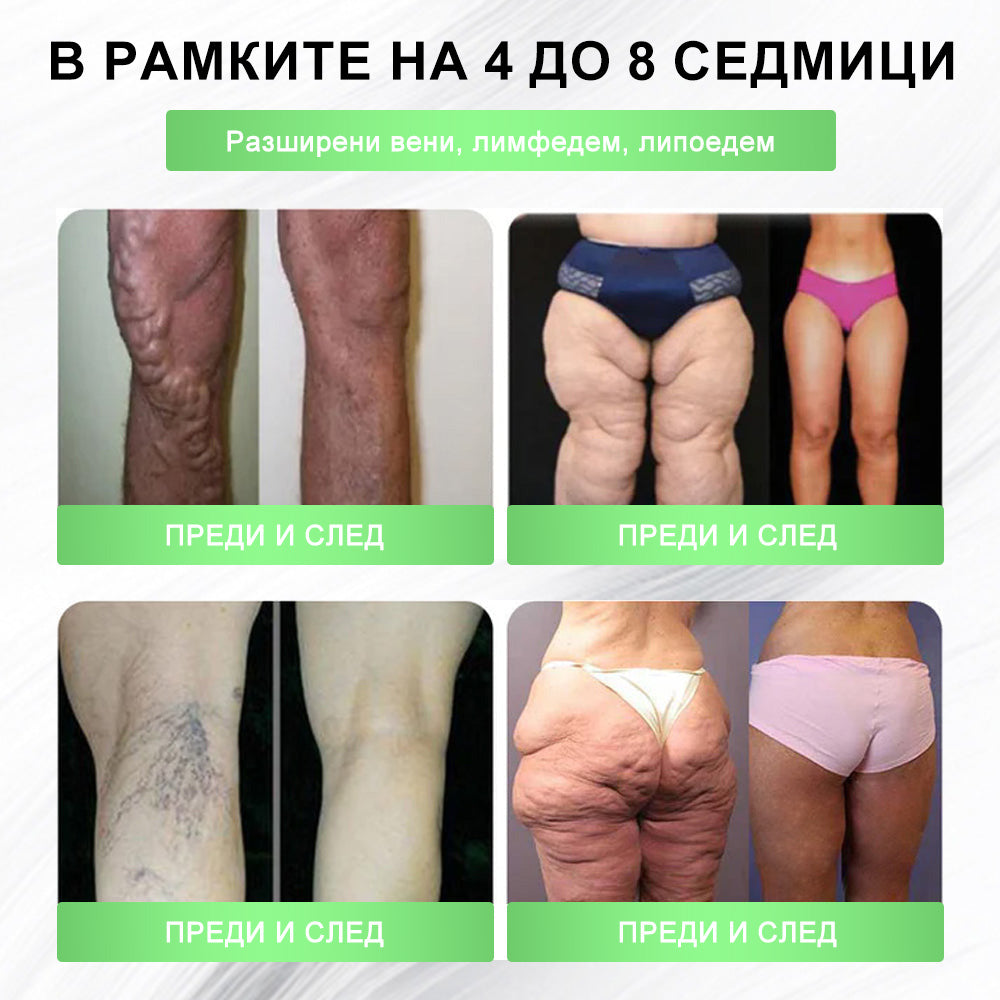 💯𝐏𝐙𝐆𝐎𝐍𝐄® Моринга·Берберин×NAD+ 10-в-1 Пластир🎁 Остават само 10 кутии! 🎁 Даваме допълнителна 50% отстъпка! Грижи се за своето здраве! Ако пропуснеш сега, тази година вече няма да има шанс!